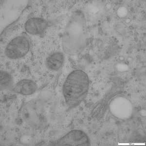 Baby Hampster Kidney (BHK) cells.