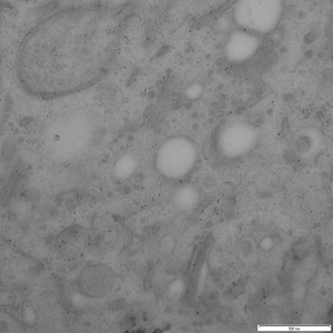 Baby Hampster Kidney (BHK) cells labeled for GFP-Rab18: immunolabeled with anti-GFP.