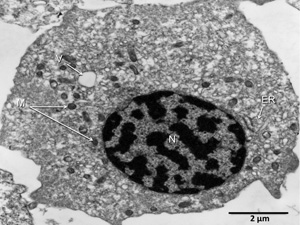 Haemocytes from the Akoya peal oyster, Pinctada imbricata. M: mitochondria; N: nucleus; V: vacuole; ER: endoplasmic reticulum.