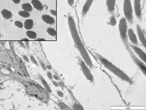 The rod-shaped secretion used in the temporary glue of Troglocephalus rhinobatidis marine parasites.