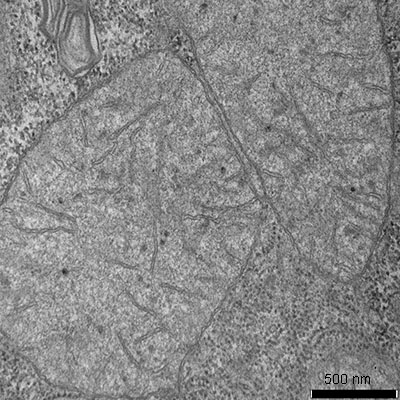 Bright field electron micrograph of mitochondria from a rat's liver.